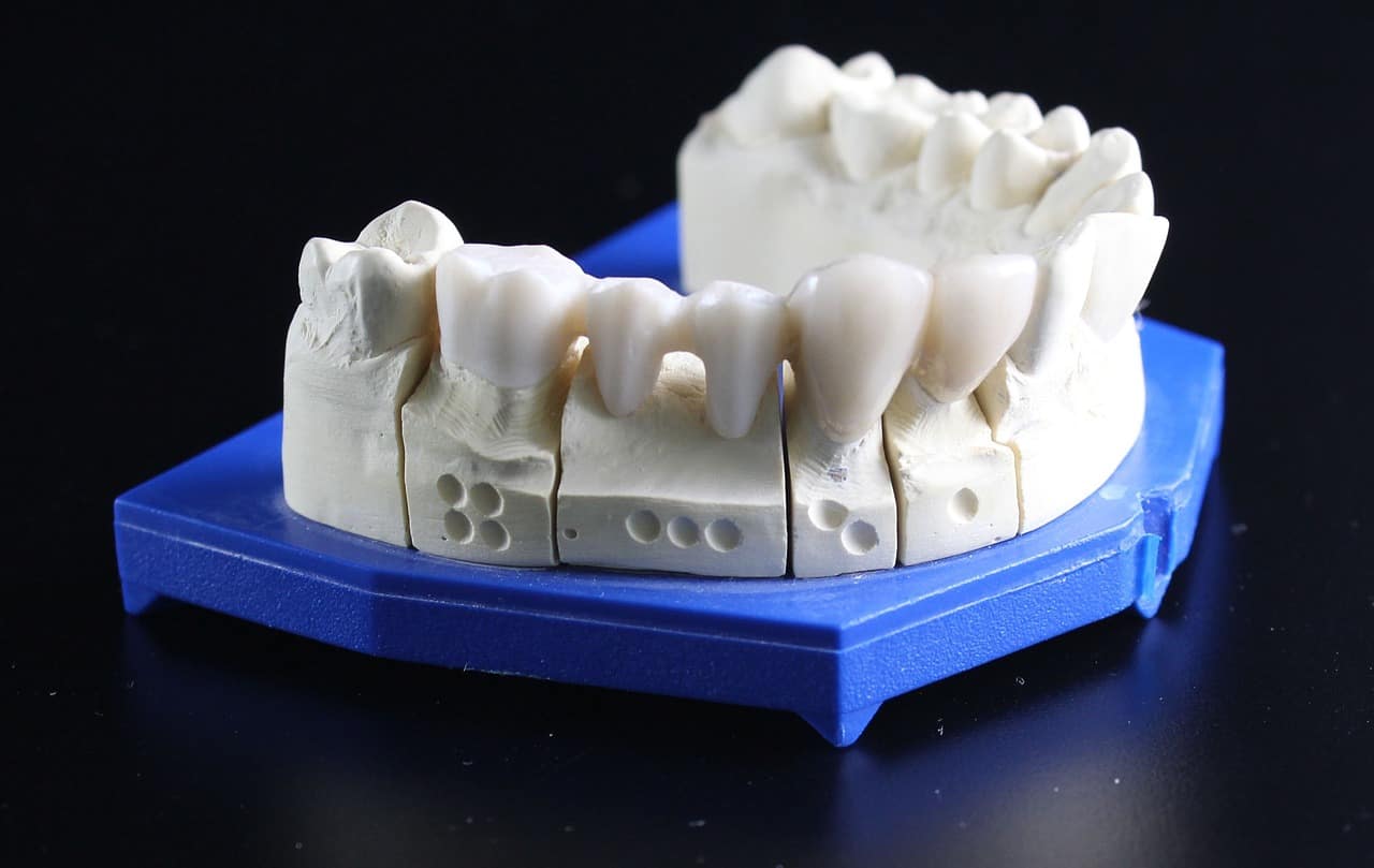 Zahnersatz-aus-3D-Druck-Fertigung Zahnersatz-3D-Druck-Symbolbild