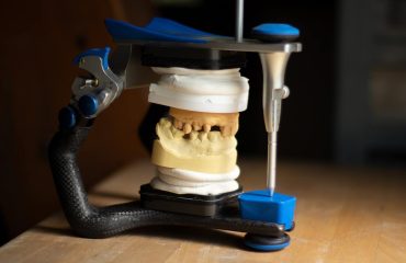 3D-Druck in der Zahnmedizin