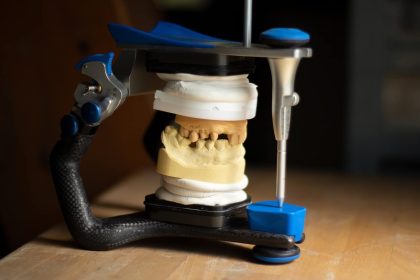 3D-Druck in der Zahnmedizin