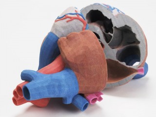 3d-druck-in-der-medizin 3D-Druck-Medizin-Herzmodell
